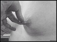 Nipple Pull