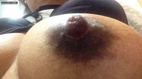 Brown Nipple